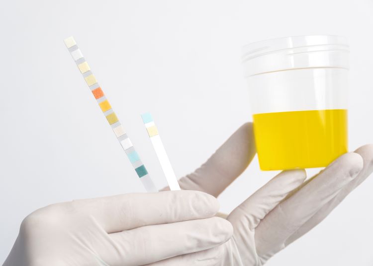 (Ilustrasi tes urine yang dilakukan di laboratorium, sumber : freepik)